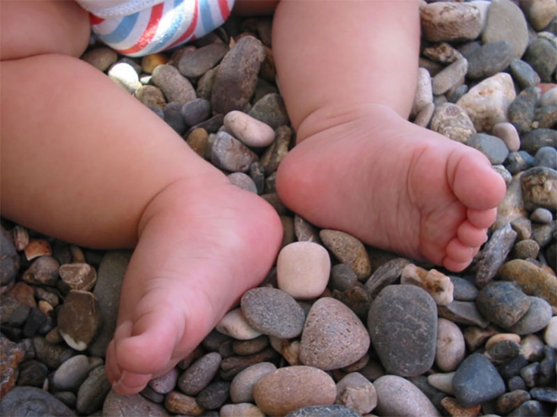 Consejo para prevenir deformidades en el pie del niño
