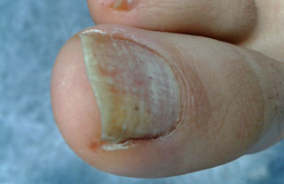 Servicio de Patologías dérmicas