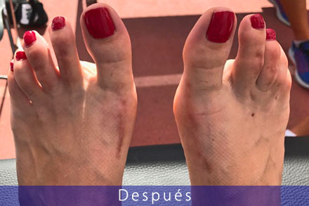 Servicio de cirujía podológica en Málaga