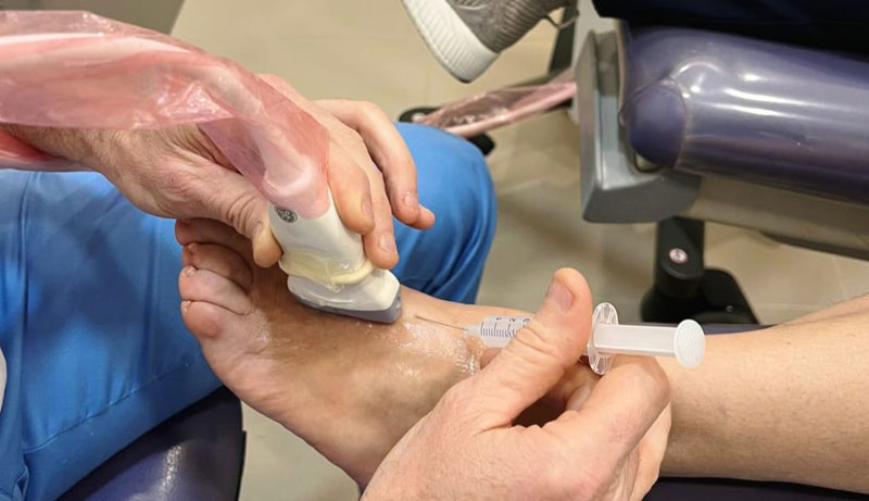 Técnica de infiltración ecoguiada en Málaga