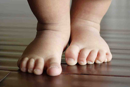 Podólogo Infantil Málaga