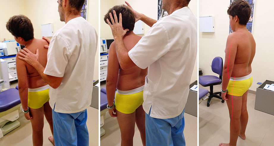 Podoposturología en Málaga