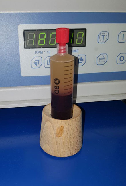 Terapia de infiltración en clínica podológica Medina